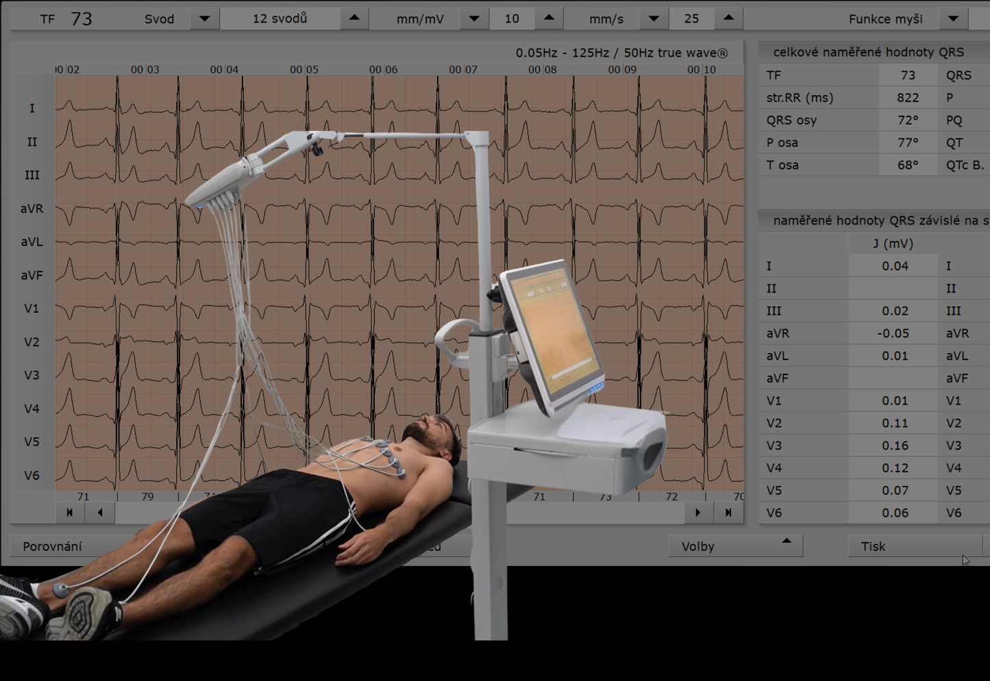 Základní sportovní prohlídka